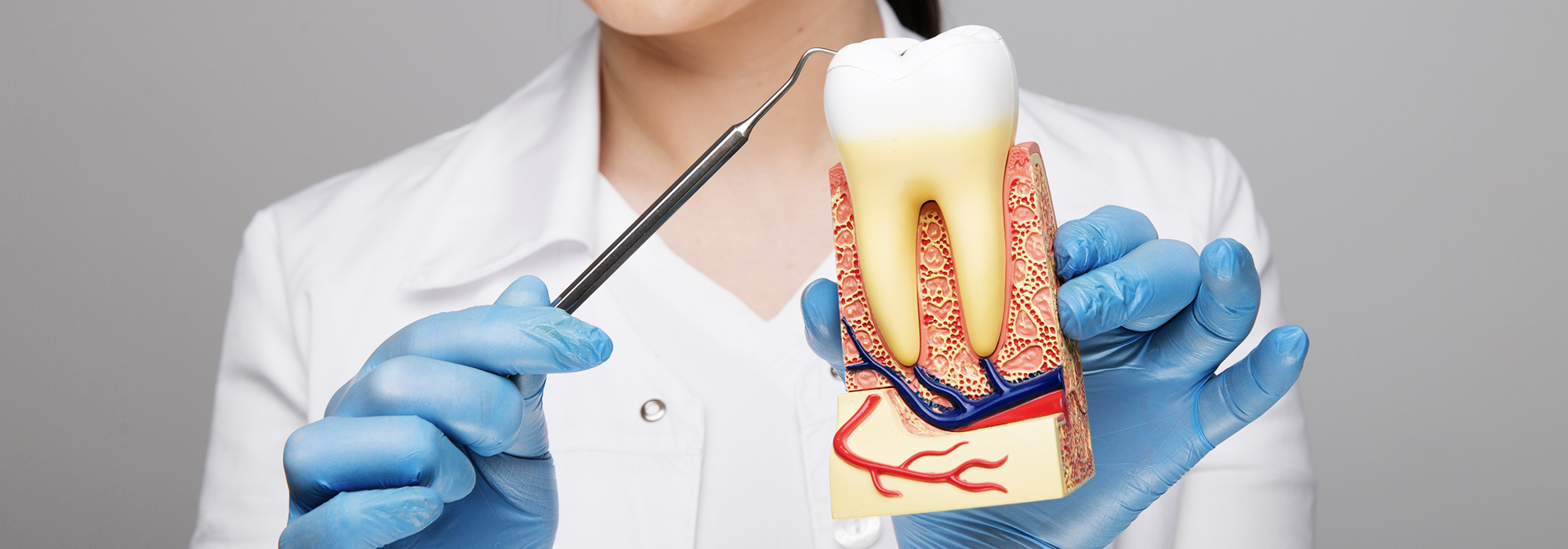 Root Canal