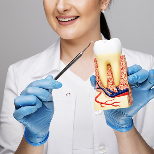Root Canal